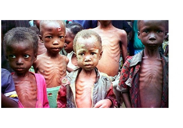 MALNUTRITION EN AFRIQUE : 15,4 MILLIONS D'ENFANT ATTEINTS